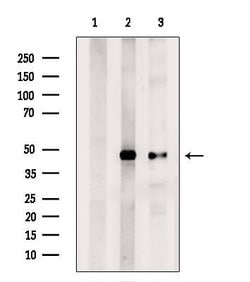Invitrogen ENO1 Polyclonal Antibody 100 &mu;L | Buy Online | Invitrogen&trade; | Fisher Scientific