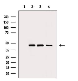 Invitrogen ENO1 Polyclonal Antibody 100 &mu;L | Buy Online | Invitrogen&trade; | Fisher Scientific