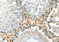 Invitrogen PSMB1 Polyclonal Antibody 100 &mu;L; Unconjugated:Antibodies,