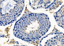 Invitrogen LYZL6 Polyclonal Antibody 100 &mu;L; Unconjugated:Antibodies,
