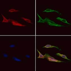 Invitrogen ARPC1A Polyclonal Antibody 100 &mu;L; Unconjugated:Antibodies,
