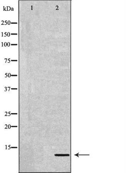 Invitrogen DEFB132 Polyclonal Antibody 100 &mu;L; Unconjugated:Antibodies,