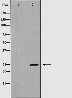 Invitrogen GPX5 Polyclonal Antibody 100 &mu;L; Unconjugated:Antibodies,