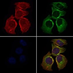 Invitrogen SLC27A2 Polyclonal Antibody 100 &mu;L; Unconjugated:Antibodies,