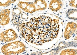 Invitrogen SLC27A2 Polyclonal Antibody 100 &mu;L; Unconjugated:Antibodies,