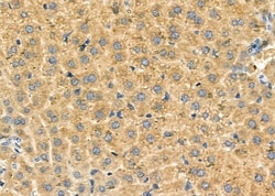 Invitrogen SLC27A2 Polyclonal Antibody 100 &mu;L; Unconjugated:Antibodies,