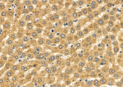 Invitrogen SLC27A2 Polyclonal Antibody 100 &mu;L; Unconjugated:Antibodies,