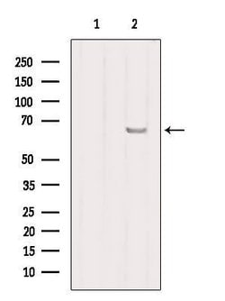 Invitrogen SLC27A2 Polyclonal Antibody 100 &mu;L; Unconjugated:Antibodies,