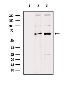 Invitrogen SLC27A2 Polyclonal Antibody 100 &mu;L; Unconjugated:Antibodies,