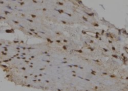 Invitrogen NUAK2 Polyclonal Antibody 100 &mu;L | Buy Online | Invitrogen&trade; | Fisher Scientific