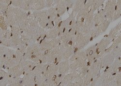Invitrogen HIP2 Polyclonal Antibody 100 &mu;L; Unconjugated:Antibodies,