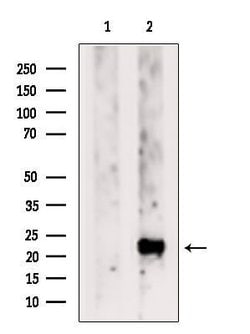 Invitrogen HIP2 Polyclonal Antibody 100 &mu;L; Unconjugated:Antibodies,