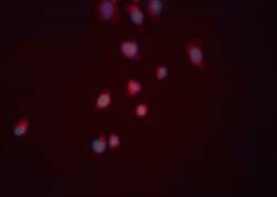 Invitrogen CYR61 Polyclonal Antibody 100 &mu;L; Unconjugated:Antibodies