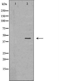 Invitrogen CYR61 Polyclonal Antibody 100 &mu;L; Unconjugated:Antibodies