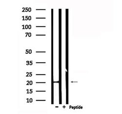 Invitrogen CRF Polyclonal Antibody 100 &mu;L | Buy Online | Invitrogen&trade; | Fisher Scientific