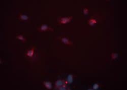 Invitrogen Cardiac Troponin T Polyclonal Antibody 100 &mu;L; Unconjugated:Antibodies,