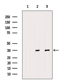 Invitrogen Fibrillarin Polyclonal Antibody 100 &mu;L; Unconjugated:Antibodies,