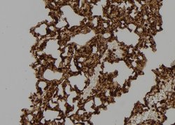 Invitrogen RAC2 Polyclonal Antibody 100 &mu;L | Buy Online | Invitrogen&trade; | Fisher Scientific