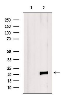 Invitrogen RAC2 Polyclonal Antibody 100 &mu;L | Buy Online | Invitrogen&trade; | Fisher Scientific