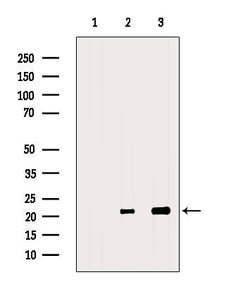 Invitrogen RAC2 Polyclonal Antibody 100 &mu;L | Buy Online | Invitrogen&trade; | Fisher Scientific