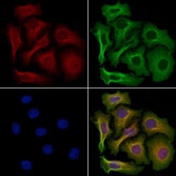 Invitrogen RAC2 Polyclonal Antibody 100 &mu;L | Buy Online | Invitrogen&trade; | Fisher Scientific