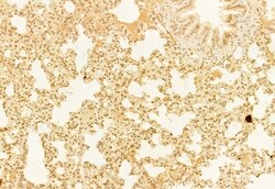 Invitrogen RAC2 Polyclonal Antibody 100 &mu;L | Buy Online | Invitrogen&trade; | Fisher Scientific