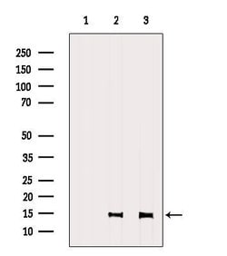 Invitrogen SH2D1A Polyclonal Antibody 100 &mu;L; Unconjugated:Antibodies,