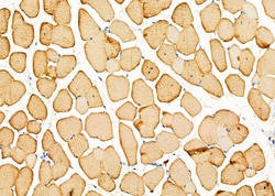 Invitrogen TPM1 Polyclonal Antibody 100 &mu;L; Unconjugated:Antibodies,