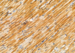 Invitrogen TPM1 Polyclonal Antibody 100 &mu;L; Unconjugated:Antibodies,