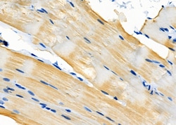 Invitrogen TPM1 Polyclonal Antibody 100 &mu;L; Unconjugated:Antibodies,