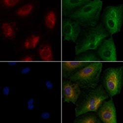 Invitrogen FAAH Polyclonal Antibody 100 &mu;L; Unconjugated:Antibodies,