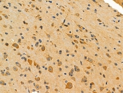 Invitrogen FAAH Polyclonal Antibody 100 &mu;L; Unconjugated:Antibodies,