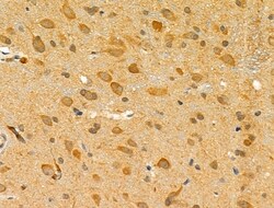 Invitrogen FAAH Polyclonal Antibody 100 &mu;L; Unconjugated:Antibodies,
