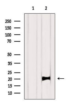 Invitrogen K-Ras Polyclonal Antibody 100 &mu;L | Buy Online | Invitrogen&trade; | Fisher Scientific