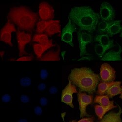 Invitrogen CD64 Polyclonal Antibody 100 &mu;L | Buy Online | Invitrogen&trade; | Fisher Scientific