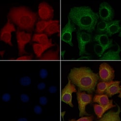 Invitrogen CD64 Polyclonal Antibody 100 &mu;L | Buy Online | Invitrogen&trade; | Fisher Scientific