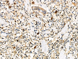 Invitrogen CD64 Polyclonal Antibody 100 &mu;L | Buy Online | Invitrogen&trade; | Fisher Scientific