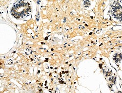 Invitrogen CD64 Polyclonal Antibody 100 &mu;L | Buy Online | Invitrogen&trade; | Fisher Scientific