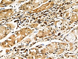 Invitrogen CD64 Polyclonal Antibody 100 &mu;L | Buy Online | Invitrogen&trade; | Fisher Scientific