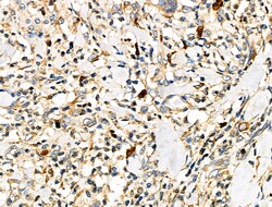 Invitrogen CD64 Polyclonal Antibody 100 &mu;L | Buy Online | Invitrogen&trade; | Fisher Scientific
