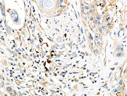 Invitrogen CD64 Polyclonal Antibody 100 &mu;L | Buy Online | Invitrogen&trade; | Fisher Scientific