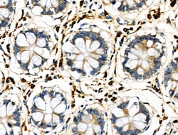 Invitrogen CD64 Polyclonal Antibody 100 &mu;L | Buy Online | Invitrogen&trade; | Fisher Scientific