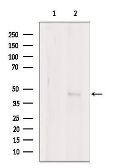 Invitrogen CD64 Polyclonal Antibody 100 &mu;L | Buy Online | Invitrogen&trade; | Fisher Scientific