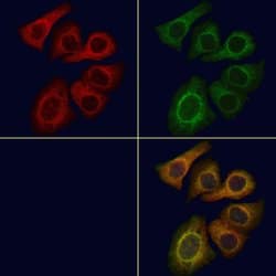 Invitrogen LCN6 Polyclonal Antibody 100 &mu;L; Unconjugated:Antibodies,