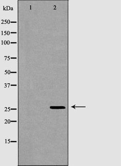 Invitrogen GSTM2 Polyclonal Antibody 100 &mu;L; Unconjugated:Antibodies,