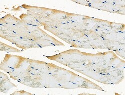 Invitrogen GSTM2 Polyclonal Antibody 100 &mu;L; Unconjugated:Antibodies,