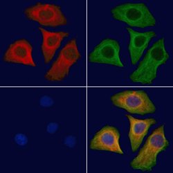 Invitrogen ATP6AP1 Polyclonal Antibody 100 &mu;L; Unconjugated:Antibodies,