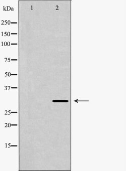Invitrogen Carbonic Anhydrase III Polyclonal Antibody 100 &mu;L; Unconjugated:Antibodies,