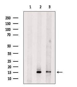 PLA2G2A Polyclonal Antibody:Antibodies, Polyclonal