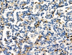 Invitrogen FCGR2A Polyclonal Antibody 100 &mu;L; Unconjugated:Antibodies,